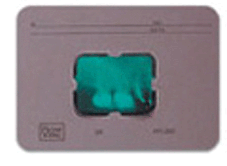 Greylight X-Ray Mounts, 10BT, # 2, 100/Pk, 610-261G product image